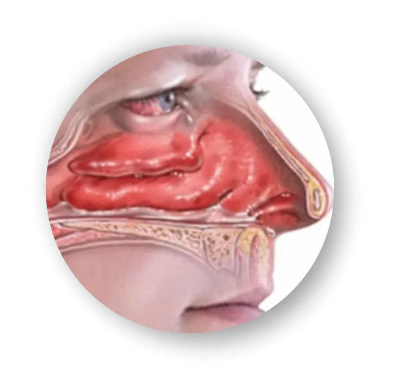 alergia.webp alergia.webp